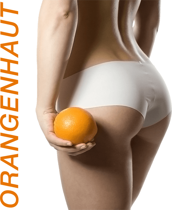 Cellulite: Hilft Joggen gegen Orangenhaut?
